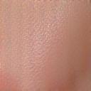Featured Guide Rosacea